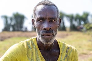 Stolzer afrikanischer Mann mit einem erblindeten Auge